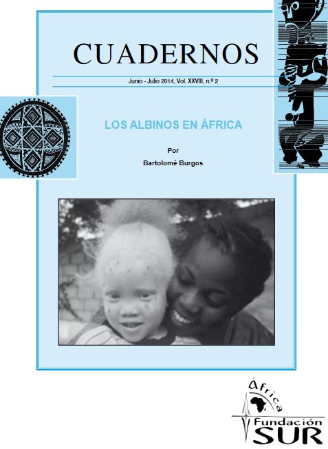 Cuaderno Junio – Julio 2014. Los albinos en África