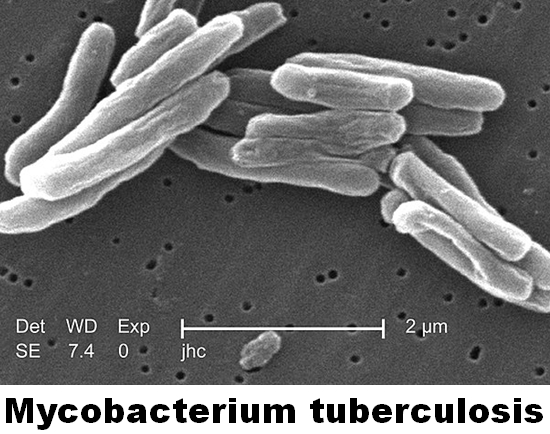 mycobacterium_tuberculosis.jpg