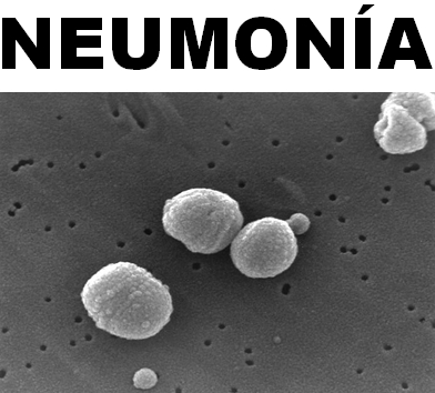 neumonia_streptococcus_pneumoniae.jpg