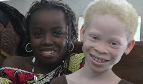 El estigma de nacer albino en África: Guinea, el primer país en aprobar una ley para protegerlos