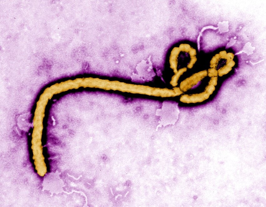 ebola_virus_cc0.jpg