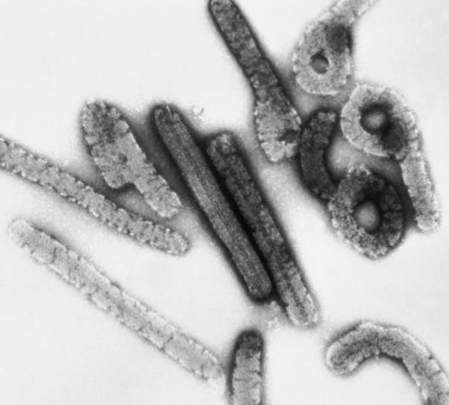 Guinea Ecuatorial confirma el primer brote de la enfermedad del virus de Marburgo